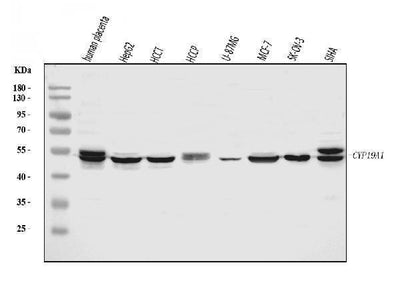 Anti-Aromatase/Cyp19a1 Antibody Picoband® Boster Bio