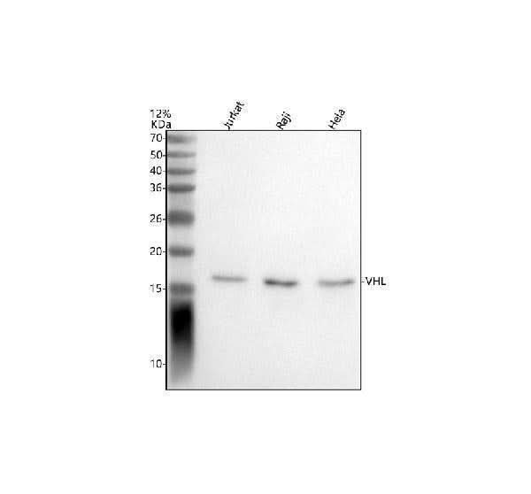 Anti-VHL Antibody Picoband® Boster Bio