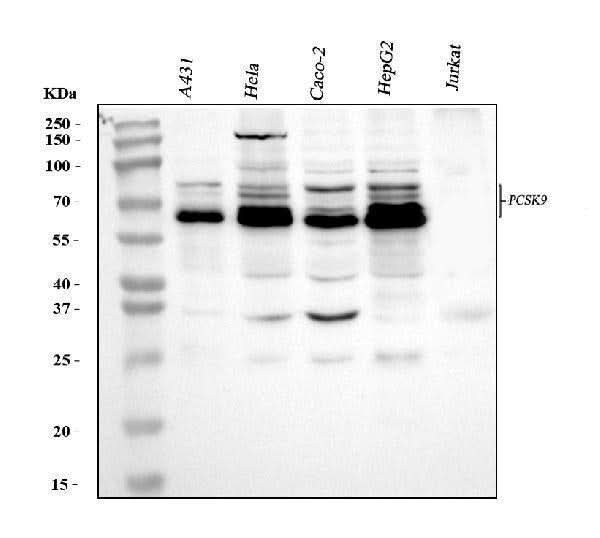 Anti-PCSK9 Antibody Picoband® Boster Bio