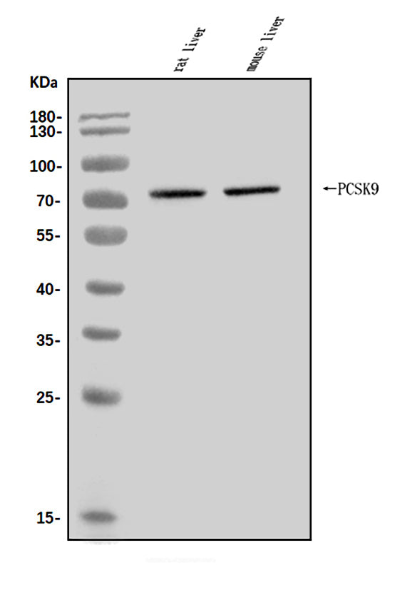 Anti-PCSK9 Antibody Picoband® Boster Bio