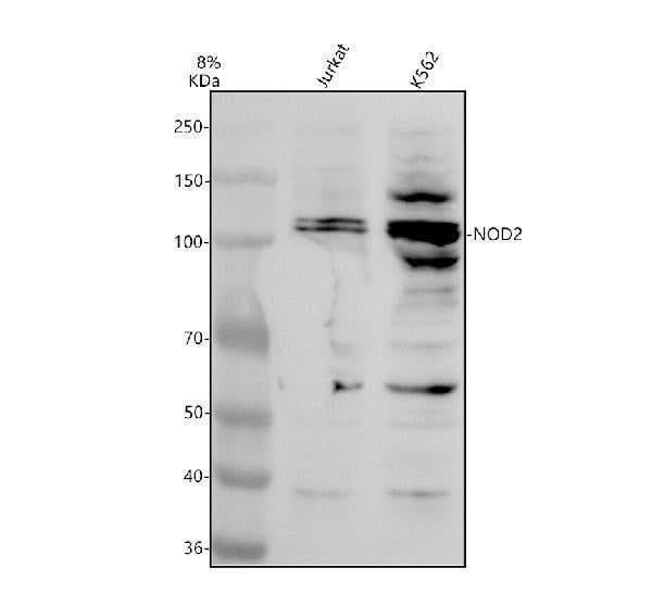 Anti-NOD2 Antibody Picoband® Boster Bio