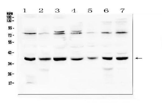 Anti-Rad51 Antibody Picoband® Boster Bio