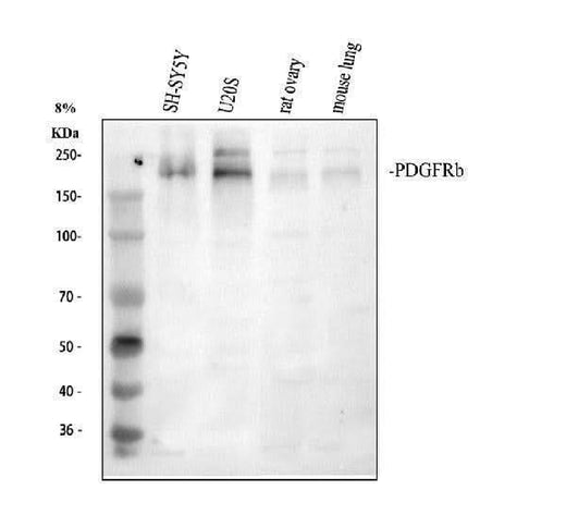 Anti-PDGF Receptor beta/PDGFRB Antibody Picoband® Boster Bio