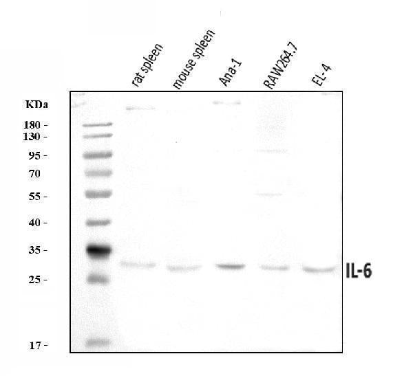 Anti-IL6 Antibody Picoband® Boster Bio