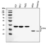 Anti-TTPA/TPP1 Antibody Picoband® Boster Bio