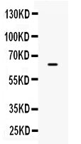 Anti-PD-L1/B7-H1/CD274 Antibody Picoband® Boster Bio
