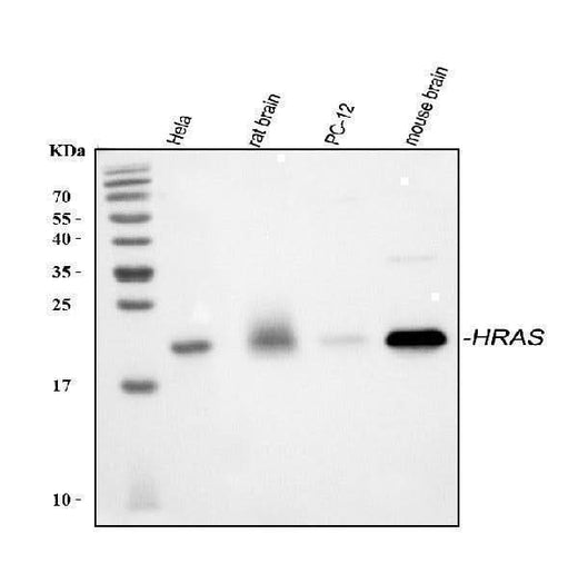 Anti-GTPase HRAS Antibody Picoband® Boster Bio