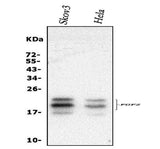 Anti-FGF2 Antibody Picoband® Boster Bio