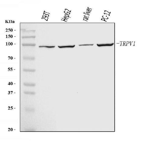 Anti-TRPV1 Antibody Picoband® Boster Bio