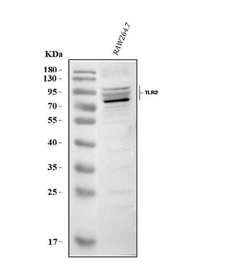 Anti-Tlr2 Antibody Picoband® Boster Bio