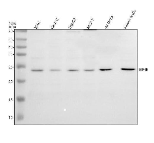 Anti-EIF4E Antibody Picoband® Boster Bio