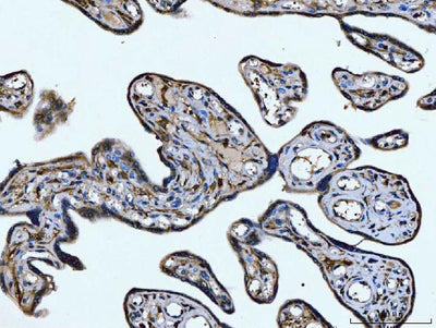 Anti-CD14 Antibody Boster Bio