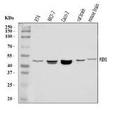Anti-Presenilin 1/PS-1/PSEN1 Antibody Picoband® Boster Bio