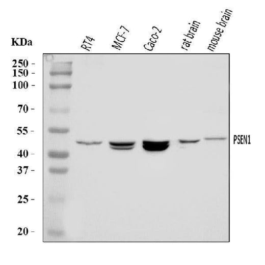 Anti-Presenilin 1/PS-1/PSEN1 Antibody Picoband® Boster Bio