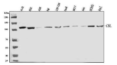 Anti-CBL Antibody Picoband® Boster Bio