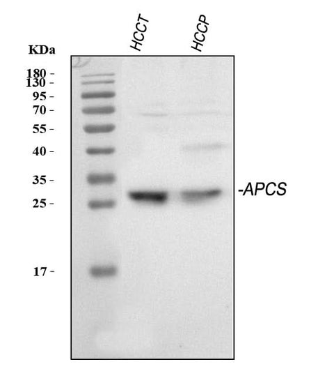 Anti-Serum Amyloid P/APCS Antibody Picoband® Boster Bio