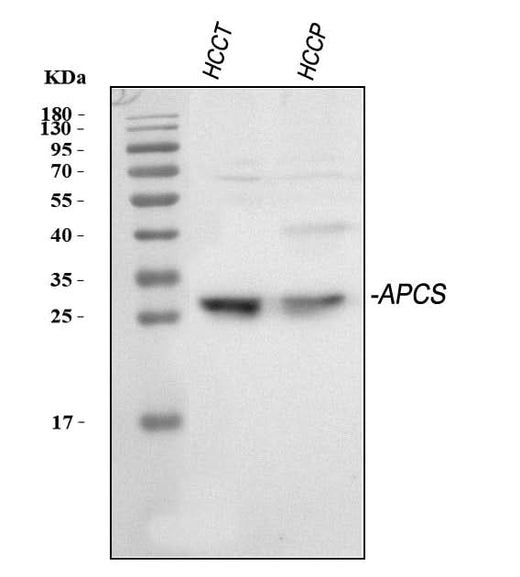 Anti-Serum Amyloid P/APCS Antibody Picoband® Boster Bio