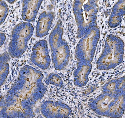 Anti-MUC1 Antibody Boster Bio