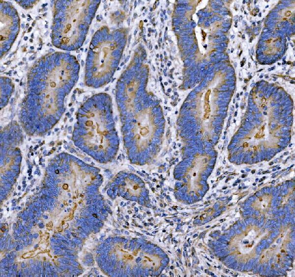 Anti-MUC1 Antibody Boster Bio