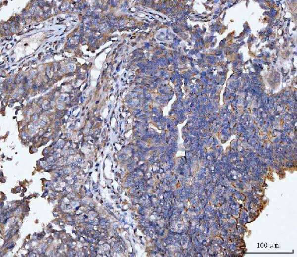 Anti-MUC1 Antibody Boster Bio