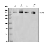 Anti-Dicer/DICER1 Antibody Picoband® Boster Bio