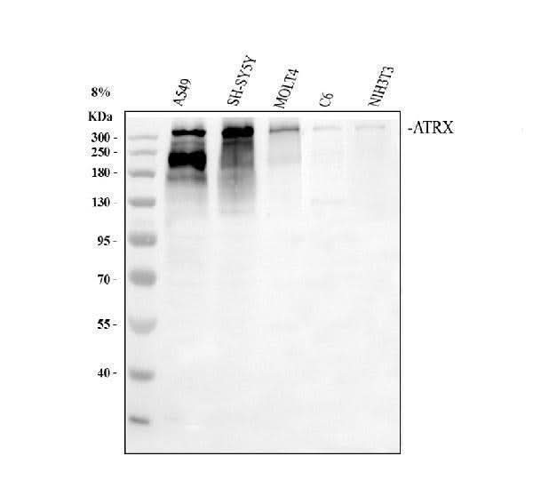 Anti-ATRX Antibody Picoband® Boster Bio