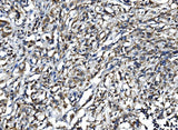 Anti-IL15 Antibody Boster Bio