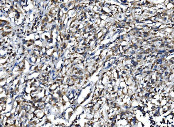 Anti-IL15 Antibody Boster Bio