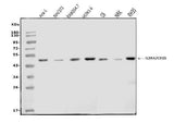 Anti-IL-2 Receptor alpha/Il2ra Antibody Picoband® Boster Bio