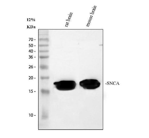 Anti-Alpha Synuclein/SNCA Antibody Picoband® Boster Bio