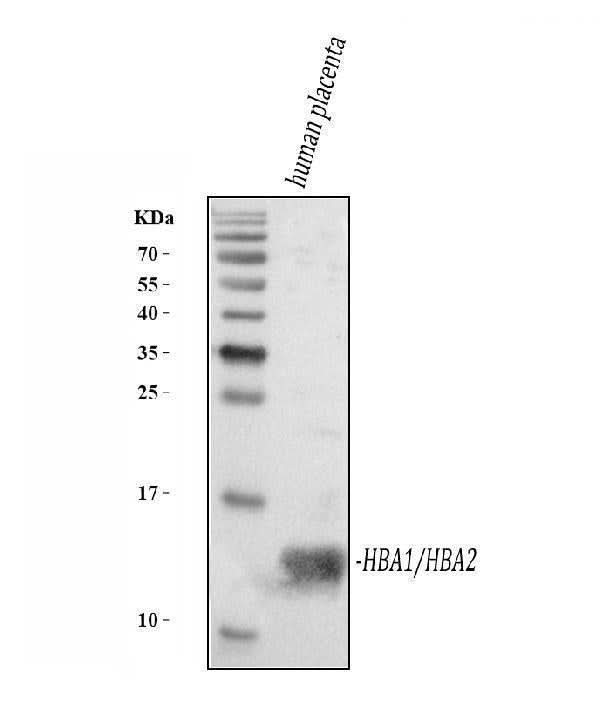 Anti-Hemoglobin/HBA1/HBA2 Antibody Picoband® Boster Bio
