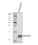 Anti-Hemoglobin/HBA1/HBA2 Antibody Picoband® Boster Bio