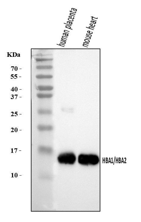 Anti-Hemoglobin/HBA1/HBA2 Antibody Picoband® Boster Bio