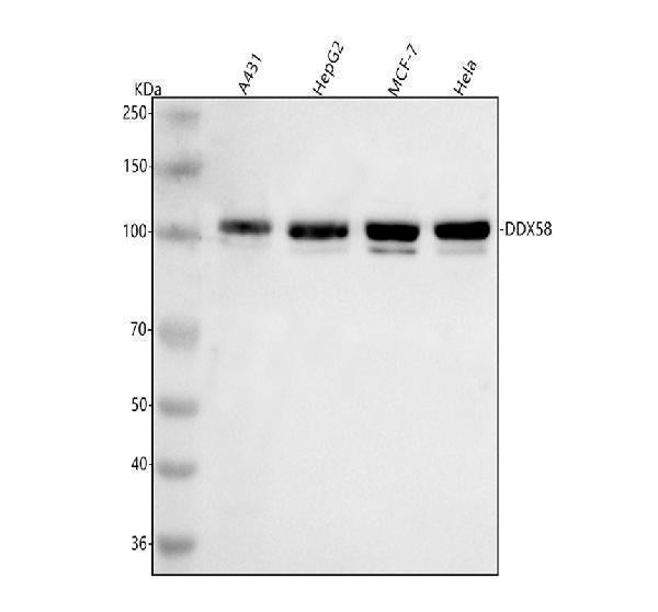 Anti-DDX58/RIG-1 Antibody Picoband® Boster Bio