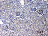 Anti-C Reactive Protein/Crp Antibody Picoband® Boster Bio