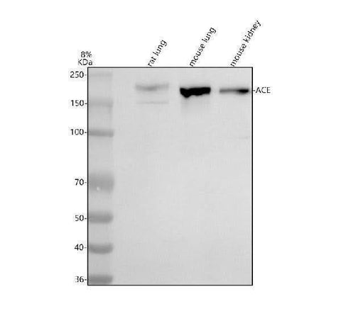 Anti-ACE Antibody Picoband® Boster Bio