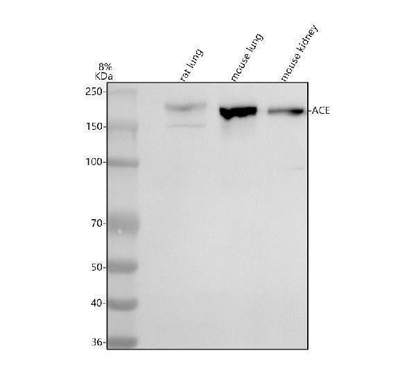 Anti-ACE Antibody Picoband® Boster Bio