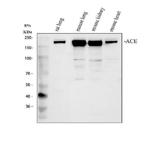 Anti-Angiotensin Converting Enzyme 1/Ace Antibody Picoband® Boster Bio