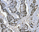 Anti-Ki67/MKI67 Antibody Boster Bio