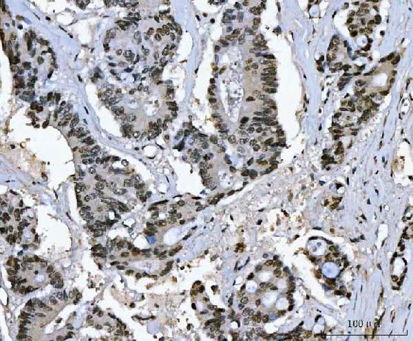 Anti-Ki67/MKI67 Antibody Boster Bio