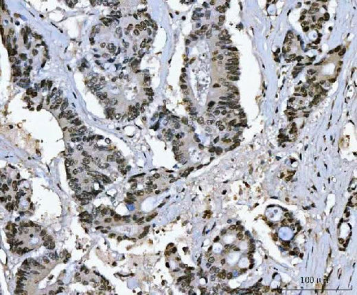 Anti-Ki67/MKI67 Antibody Boster Bio