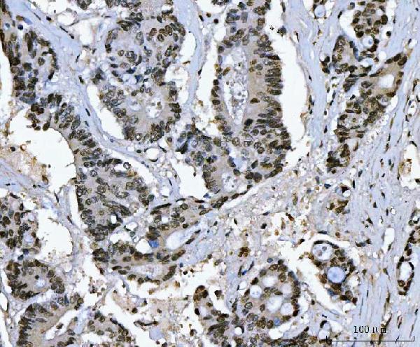 Anti-Ki67/MKI67 Antibody Boster Bio