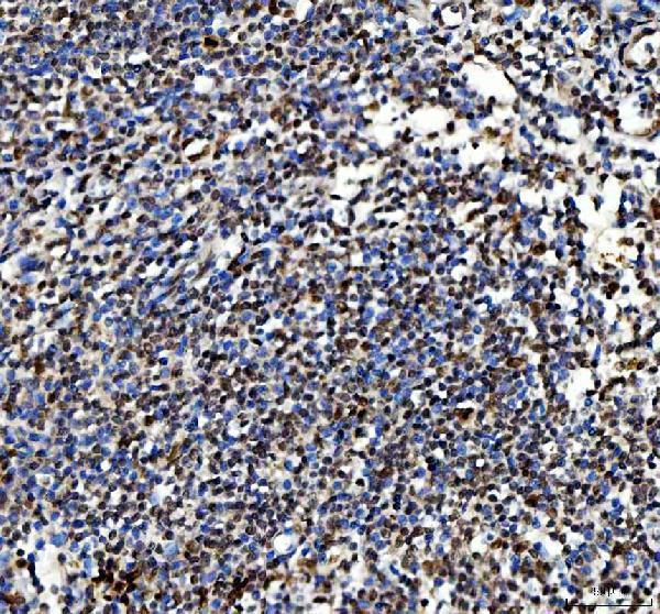 Anti-Ki67/Mki67 Antibody Boster Bio