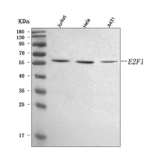Anti-E2F1 Antibody Picoband® Boster Bio
