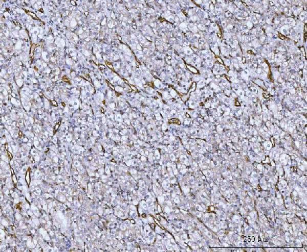 Anti-Von Willebrand Factor/VWF Antibody Boster Bio