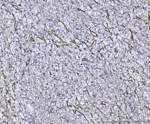 Anti-Von Willebrand Factor/VWF Antibody Boster Bio