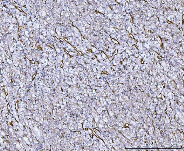 Anti-Von Willebrand Factor/VWF Antibody Boster Bio