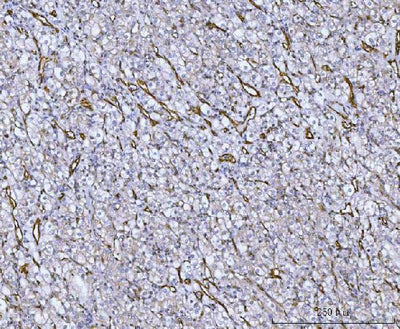 Anti-Von Willebrand Factor/VWF Antibody Boster Bio