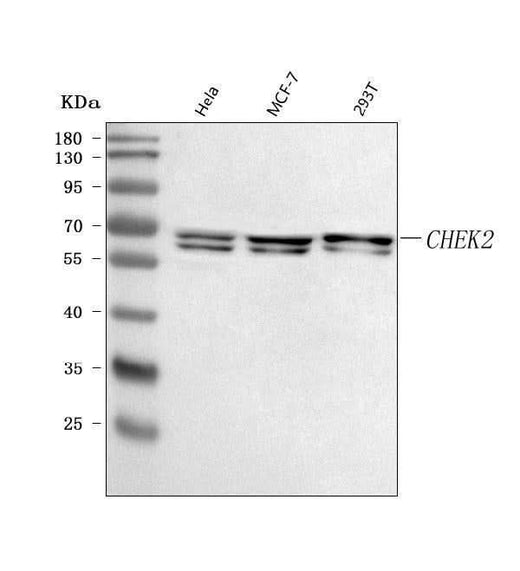 Anti-CHEK2 Antibody Picoband® Boster Bio
