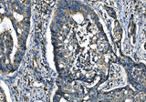 Anti-CX3CR1 Antibody Boster Bio